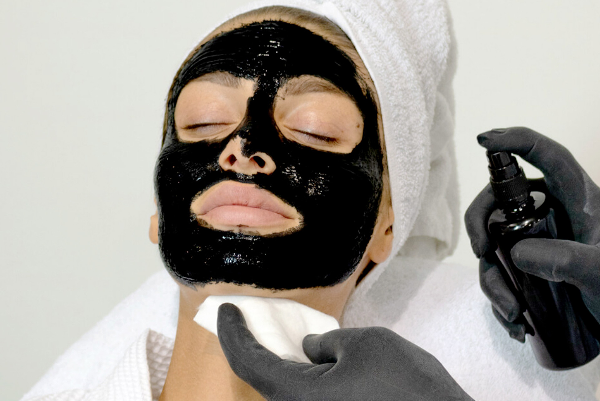 Nyhet! Carbon Peel uten laser Nyhet! Carbon Peel uten laser